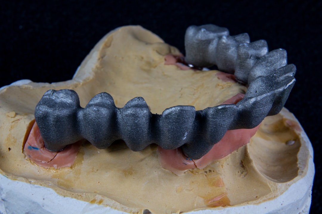 Fog implantátum beültetés lépései