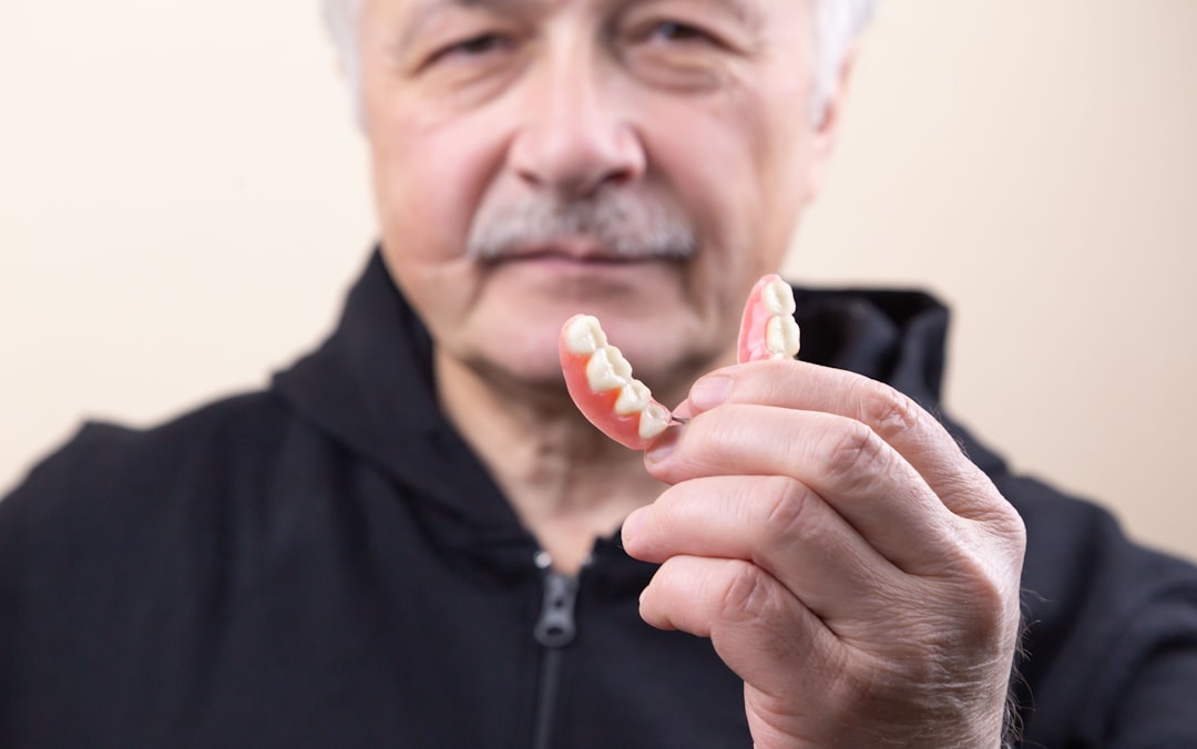 Szájpadlás nélküli kivehető fogsor